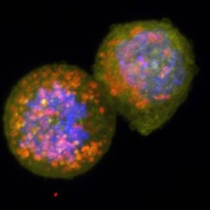 Έρευνα Πανεπιστημίου John Hopkins:Τα καρκινικά κύτταρα τρέφονται. Με τι..;