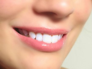 Λεύκανση Δοντιών – Απαντούμε στις συχνότερες ερωτήσεις που γίνονται στο ιατρείο
