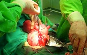 Σοκ για τους γιατρούς: Πήγε να γεννήσει αλλα δεν έβγαλε ..μωρό!