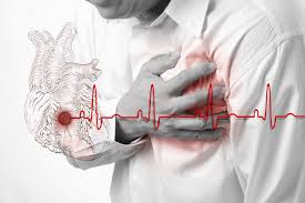 Ποιες είναι οι ενέργειες που πρέπει να κάνετε για να επιβιώσετε από μια καρδιακή προσβολή...φυσικά όχι το να βήξετε!