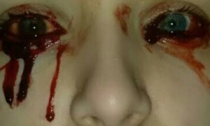 ΣΟΚ με 17χρονη: Τρέχει συνεχώς αίμα από τα μάτια και τα αυτιά της – Άναυδοι οι γιατροί