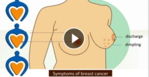 ΜΗΝ ΤΟ ΠΡΟΣΠΕΡΝΑΣ! Απλός και εύκολος τρόπος να διαπιστώσεις αν έχεις καρκίνο του μαστού!