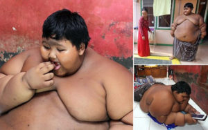 Αυτό είναι το πιο παχύσαρκο παιδί στον κόσμο ζυγίζει 192 κιλά και είναι 10 ετών