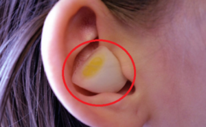Καταπληκτικό! – Εσείς ξέρατε τι θα συμβεί αν βάλετε σκόρδο στο αυτί σας;; Αν ΟΧΙ δείτε το ΕΔΩ !!!