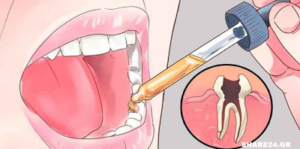12 Γιατροσόφια για τον Πονόδοντο που δεν θα Σας Πει Ποτέ ο Οδοντίατρος