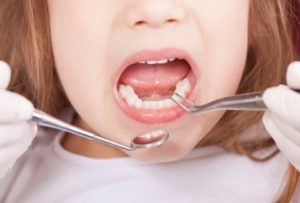 Ο Χριστός και η Παναγία!! – ΔΕΙΤΕ τι βρήκε οδοντίατρος στο στόμα μίας 7χρονης… (PHOTO)