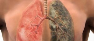 Κάπνισμα: Φτιάξτε «ελιξίριο» καθαρισμού των πνευμόνων σας (φωτό)