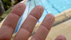 Γιατί ζαρώνουν τα δάχτυλά σας μέσα στο νερό – Δεν είναι επειδή «μούλιασαν»…